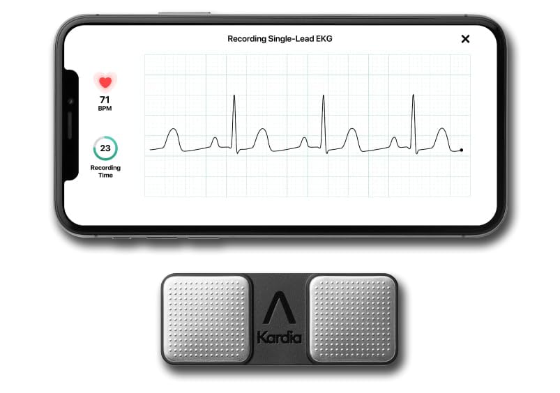 KardiaMobile 1-Lead Personal EKG Monitor – Record at Home – Detects AFib &amp; Irregular Arrhythmias – Easy Results in 30 Seconds – Works w/Most Smartphones - FSA/HSA Eligible