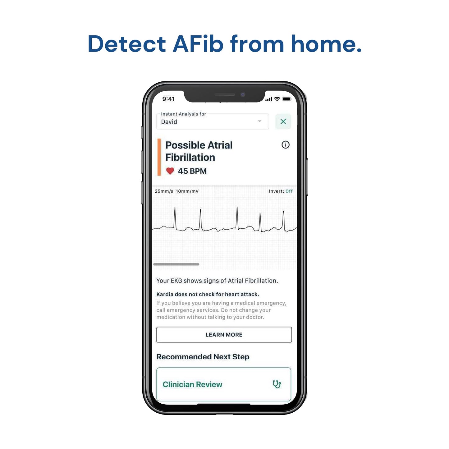 KardiaMobile 1-Lead Personal EKG Monitor – Record at Home – Detects AFib &amp; Irregular Arrhythmias – Easy Results in 30 Seconds – Works w/Most Smartphones - FSA/HSA Eligible