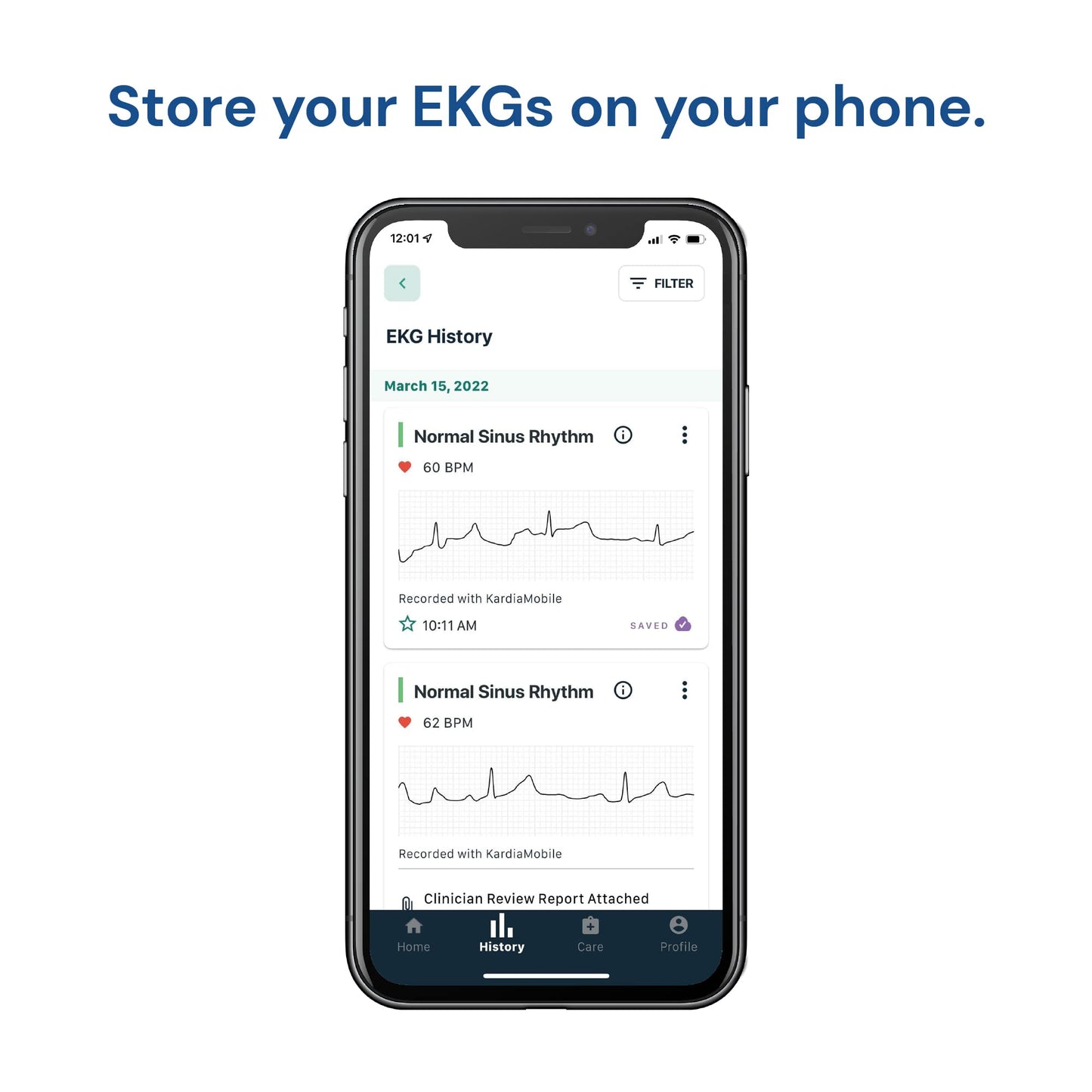 KardiaMobile 1-Lead Personal EKG Monitor – Record at Home – Detects AFib &amp; Irregular Arrhythmias – Easy Results in 30 Seconds – Works w/Most Smartphones - FSA/HSA Eligible